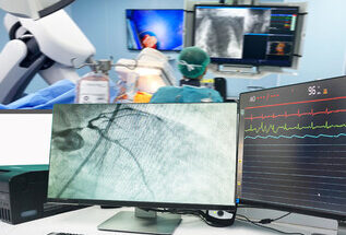 Angiography Equipment Market Growth