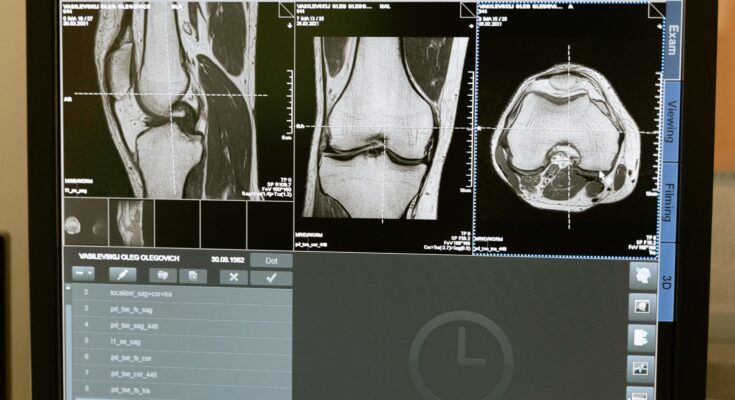 Small Animal Imaging (In-Vivo) Market