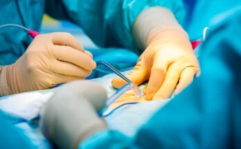 electrosurgical devices and equipment market