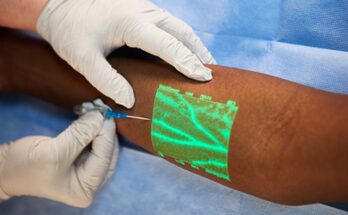 vein illuminator market