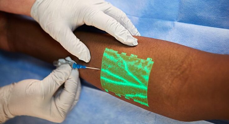 vein illuminator market