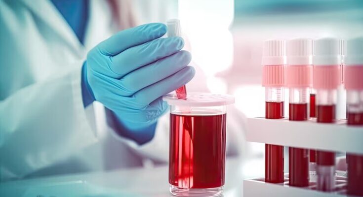 Blood Culture Tests Market