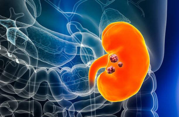 Nephrology And Urology Devices Market Size, Trends and Global Forecast To 2032
