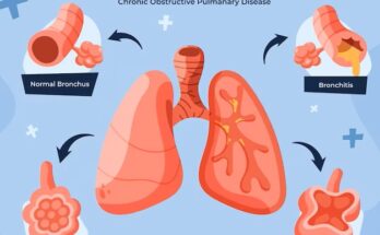 Anti-Asthmatics And COPD Drugs Market Size