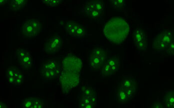 Immunofluorescence Assay