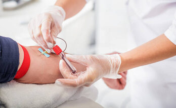 Blood Transfusion Diagnostics Global Market