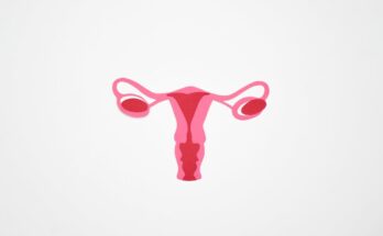 Uterine Fibroids Treatment Marke