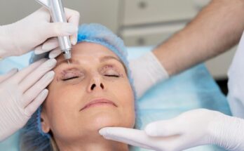 Blepharoplasty Market