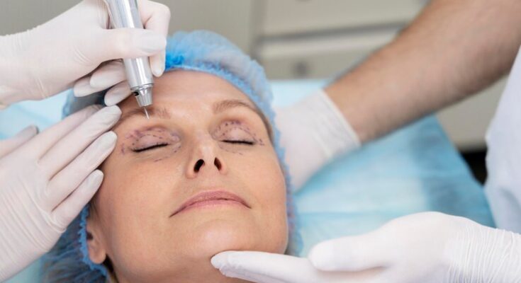 Blepharoplasty Market