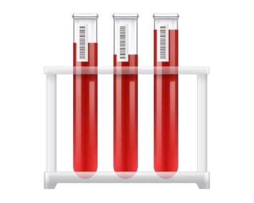 Global Blood Collection Tubes Market