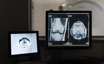 Digital X-Ray Devices Market Overview