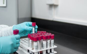 Lateral Flow Immunoassay (LFIA) Based Rapid Test Market