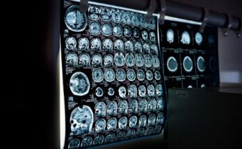 Multiplex Biomarker Imaging Market Size, Growth, Report 2033