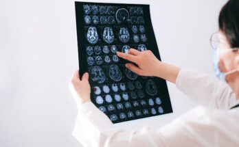 Traumatic Brain Injuries Assessment And Management Devices Global Market