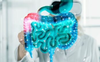 Bowel Management Systems Market Report 2024 - Bowel Management Systems Market Forecast and Trends