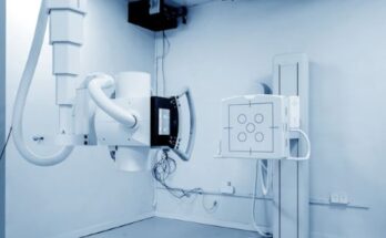 Diagnostic X-Ray System Market Report 2024 - Diagnostic X Ray System Industry Outlook And Market Forecast