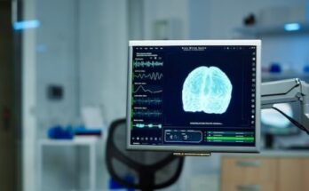 Brain Imaging Modalities Market Report 2024 - Share and Insights