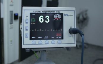 Ecg Devices Market Report 2024 - Ecg Devices Market Analysis And Forecast By 2033