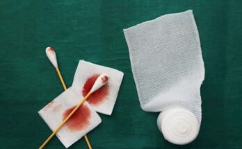 Wound Debridement Market Report 2024 - Wound Debridement Market Trends And Forecast