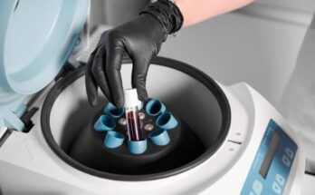 Cryostat Market Report 2025 - Cryostat Market Overview And Forecast To 2034