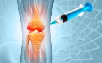 Joint Pain Injections Market Report 2025- Joint Pain Injections Market Outlook, Trends And Share